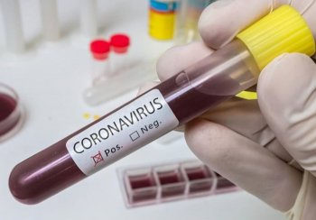 Қызылордада оронавирустық инфекцияның 3 жағдайы тіркелді