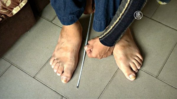 АЯҒЫ ҮЛКЕН 20 ЖАСТАҒЫ ВЕНЕСУЭЛА АЗАМАТЫ (СУРЕТ, ВИДЕО)