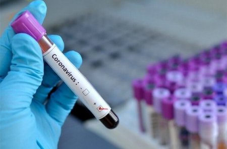 Қызылордада өңірімізде коронавирус инфекциясын тағы 5 адам жұқтырған