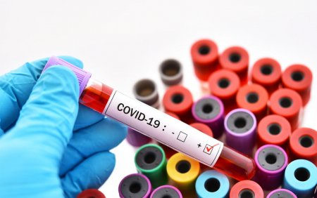 Қызылордада 12 қарашада 2 адам коронавирус инфекциясына шалдықты
