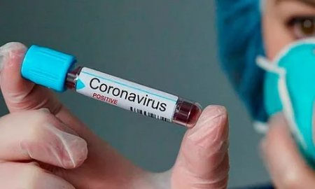 Өткен тәулікте Қызылордада 12 адам коронавирус жұқтырды